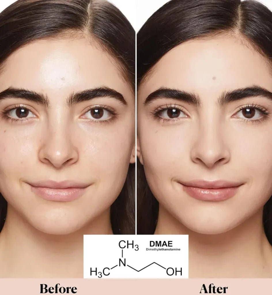 SlimSpa The Body Care Specialists - DMAE Anti-Aging Mesotherapy Vials – Professional Non-Surgical Bio-Lifting, Face & Neck Firming (DMAE · HA · Peptides, 5x10ml)