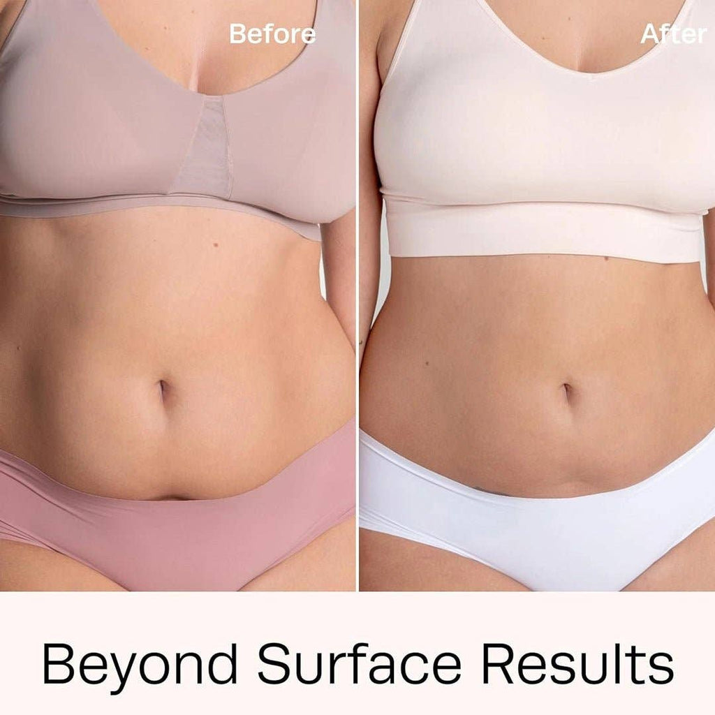 SlimSpa The Body Care Specialists - Lipex Lipolysis Vials – Professional Fat Reduction & Body Sculpting Mesotherapy (5x10ml)