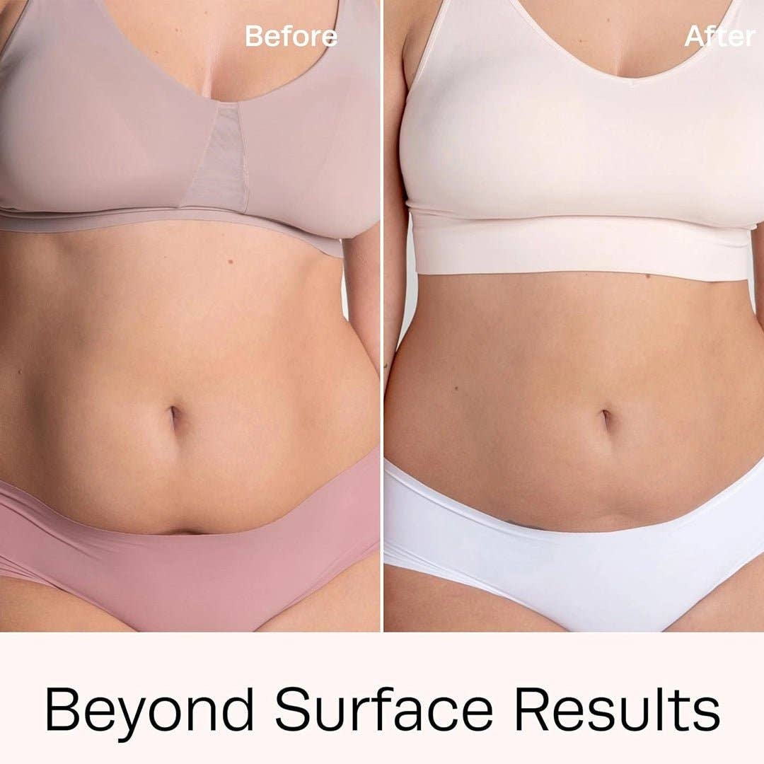 SlimSpa The Body Care Specialists - Lipex Lipolysis Vials – Professional Fat Reduction & Body Sculpting Mesotherapy (5x10ml)